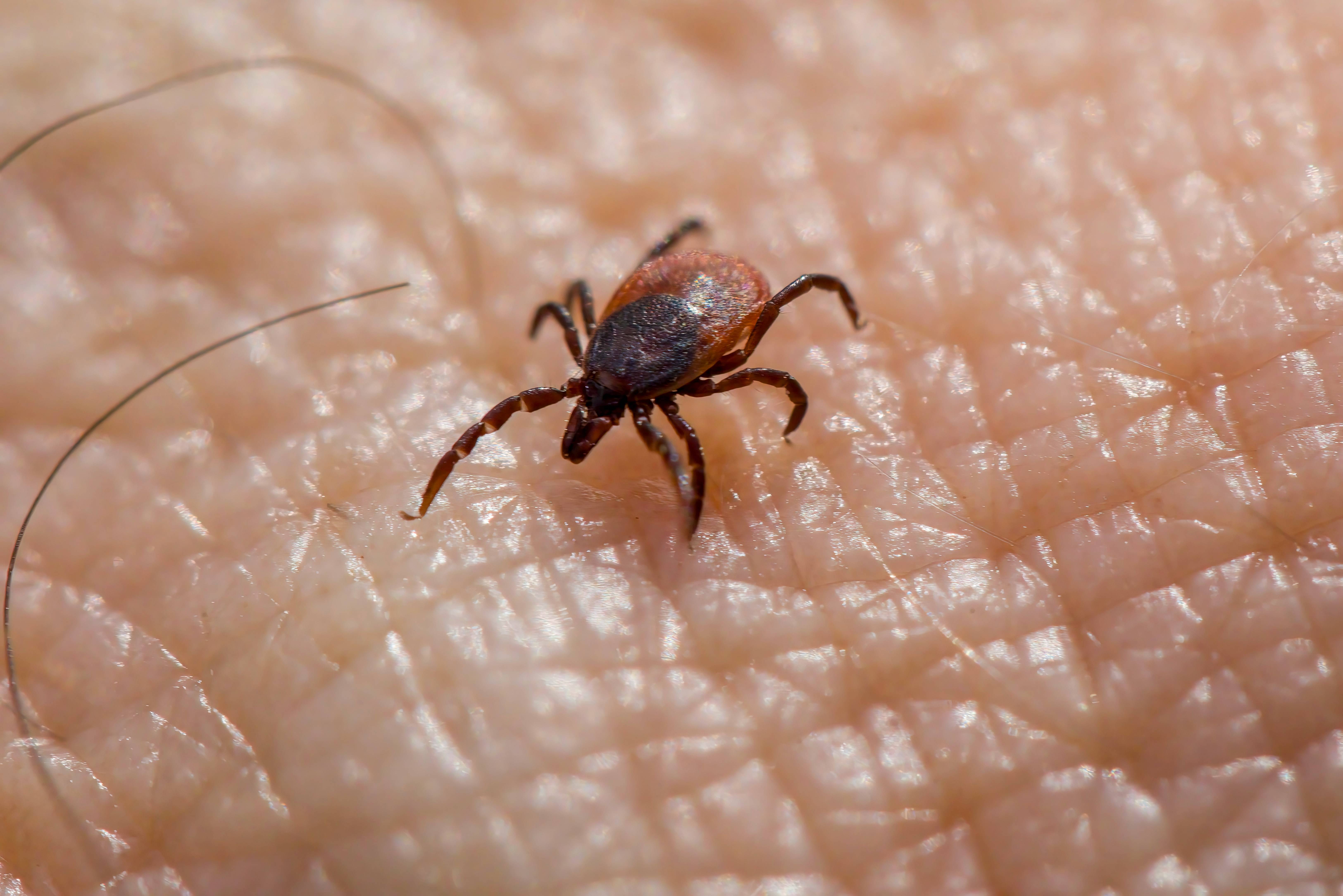 A tick on the skin.
