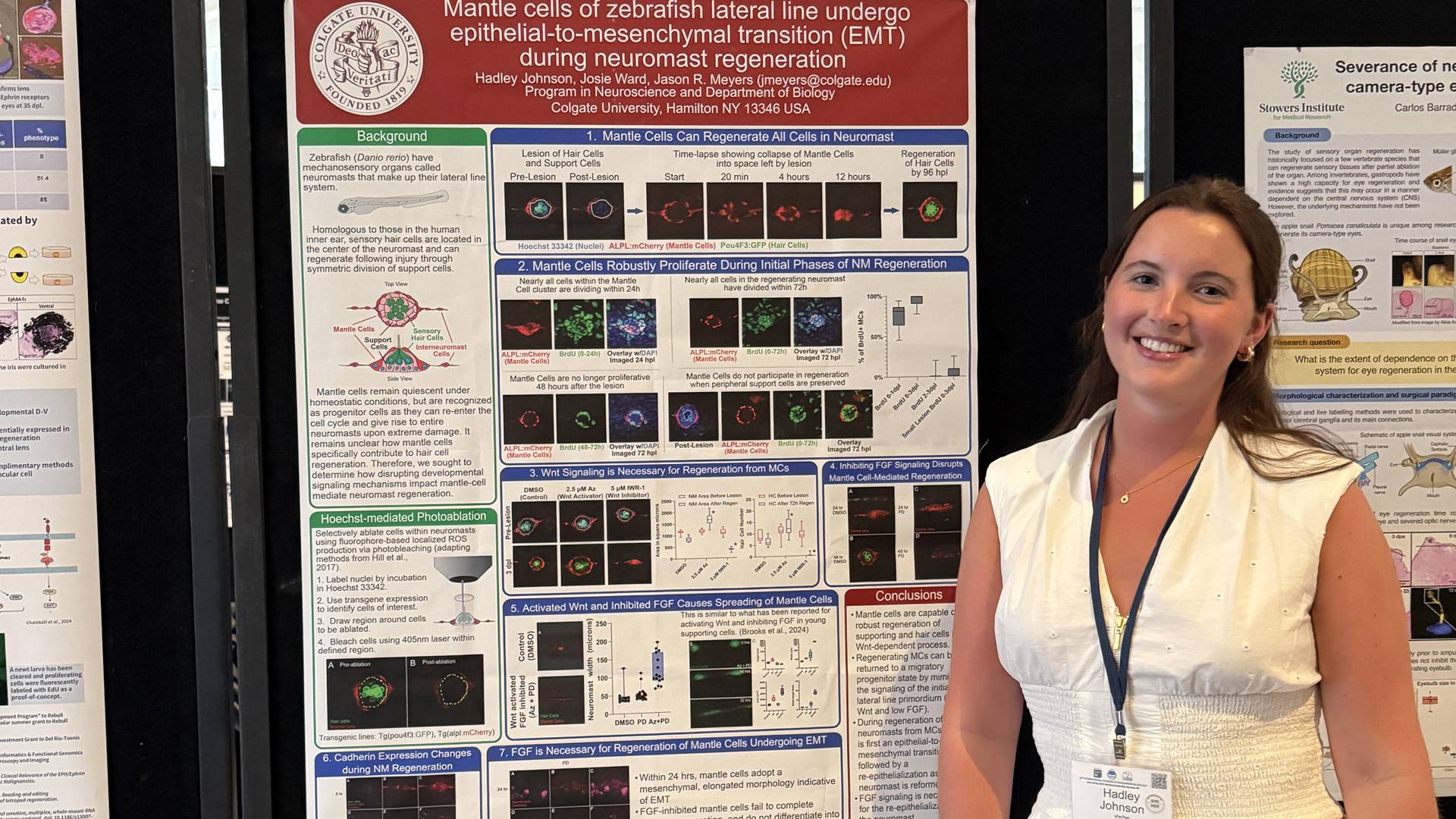 Hadley Johnson ’25 presents data from her neuroscience thesis at the Society for Developmental Biology Conference, June 2025. 